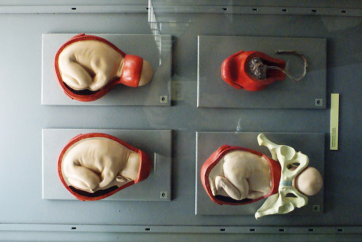 Vernisáž výstavy Evropa, kolébka vědeckého porodnictví, 7. května 2009, Národní muzeum Praha, foto: Jan Karlovský
